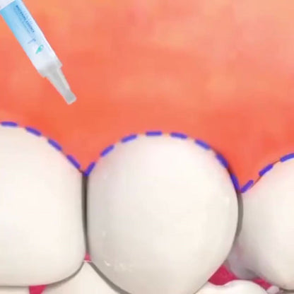 BLANQUEADOR DENTAL ULTRA 4K